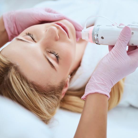 PROFESSIONELLES MICRONEEDLING MIT RADIOFREQUENZ